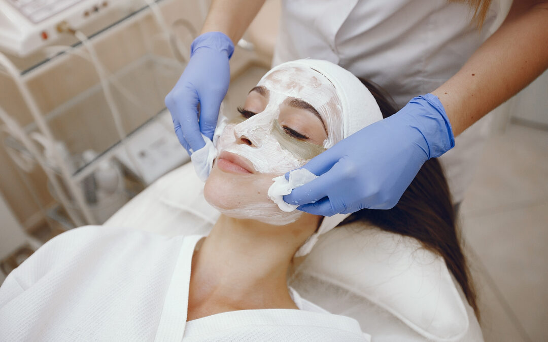chemical peel facial