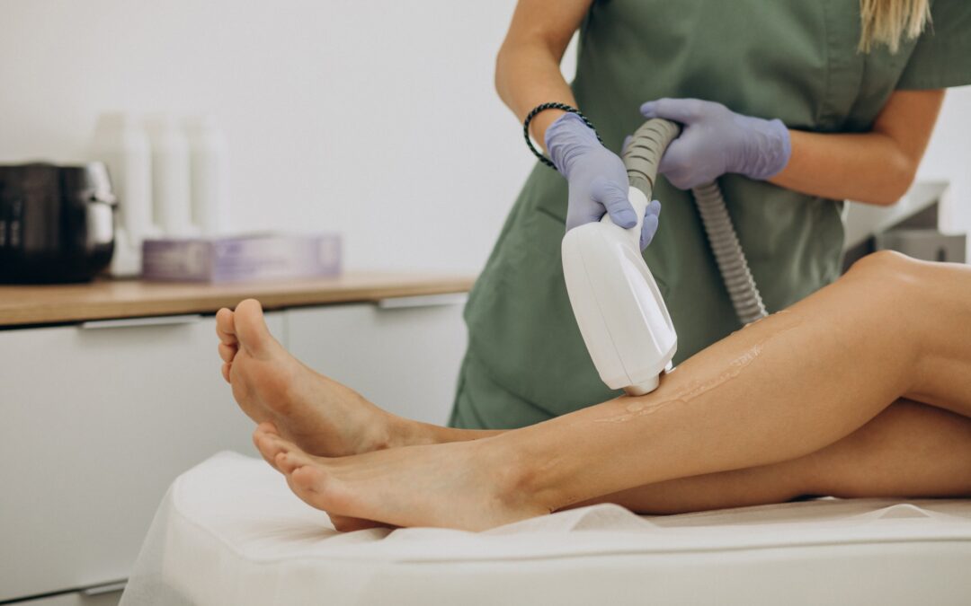 laser hair removal treatments